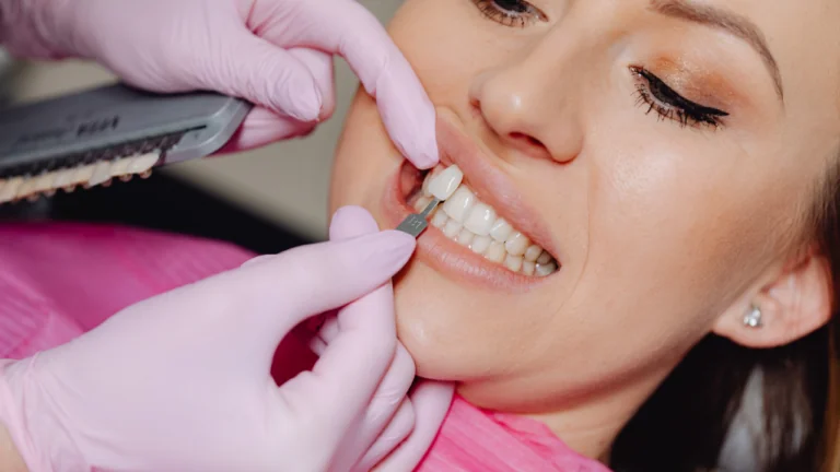 Hollywood Smile: Mükemmel Gülüşün Adım Adım Rehberi