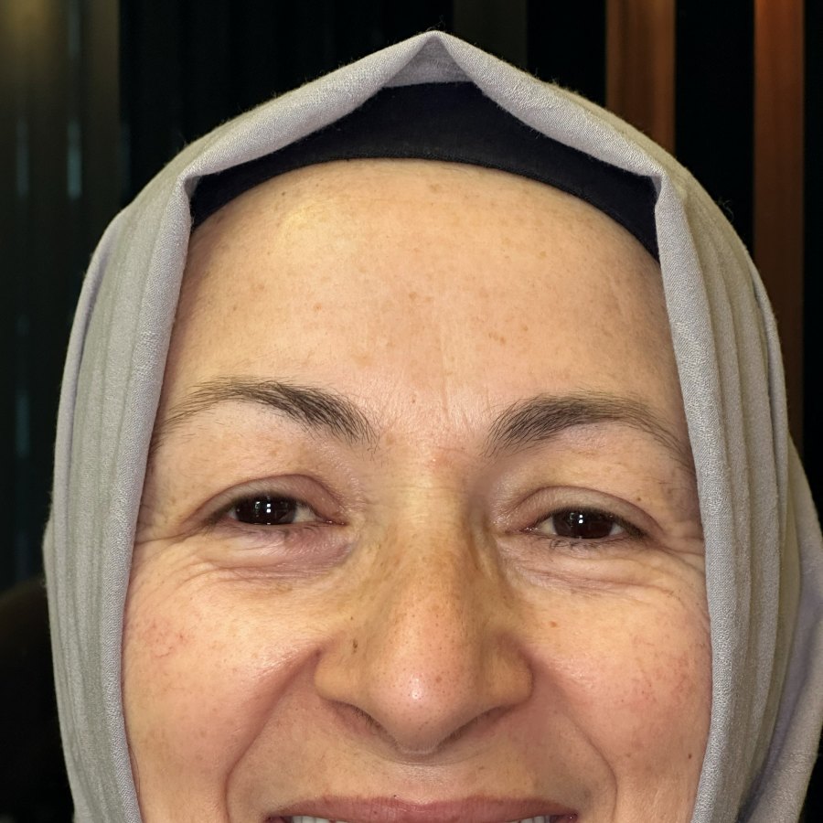 Deltadiş hasta vakası
